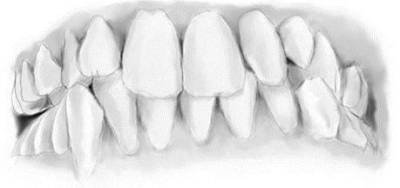 Gebiss der unbekannten Toten. Im Original könnten die Zähne verfärbt gewesen sein.
